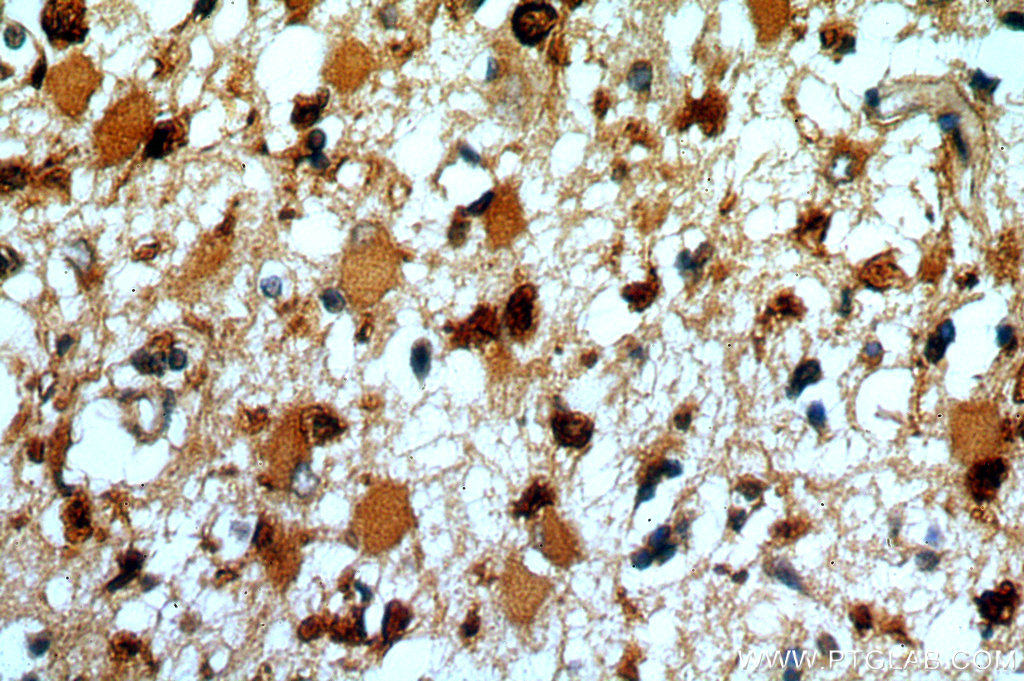 IHC staining of human brain using 15413-1-AP