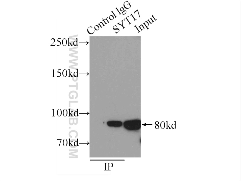 IP experiment of mouse brain using 15413-1-AP