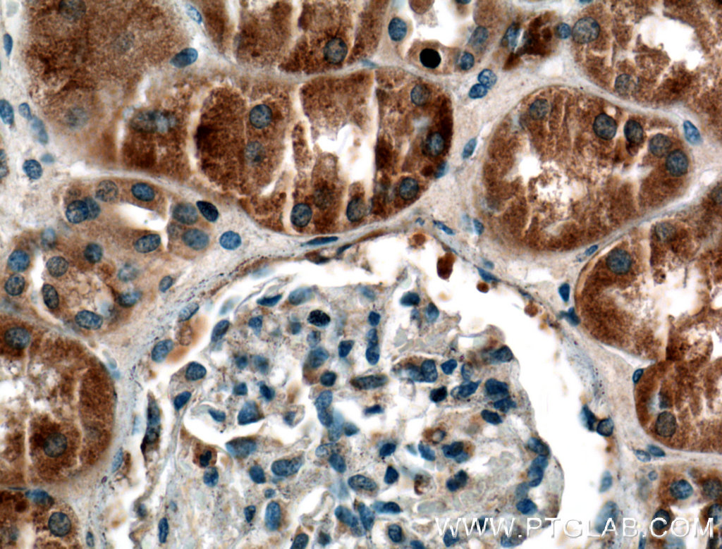 IHC staining of human kidney using 22076-1-AP