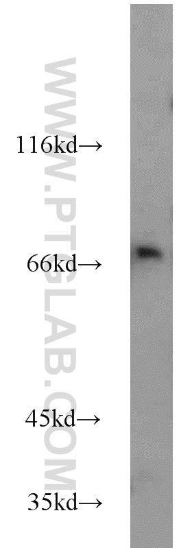 WB analysis of mouse liver using 22076-1-AP