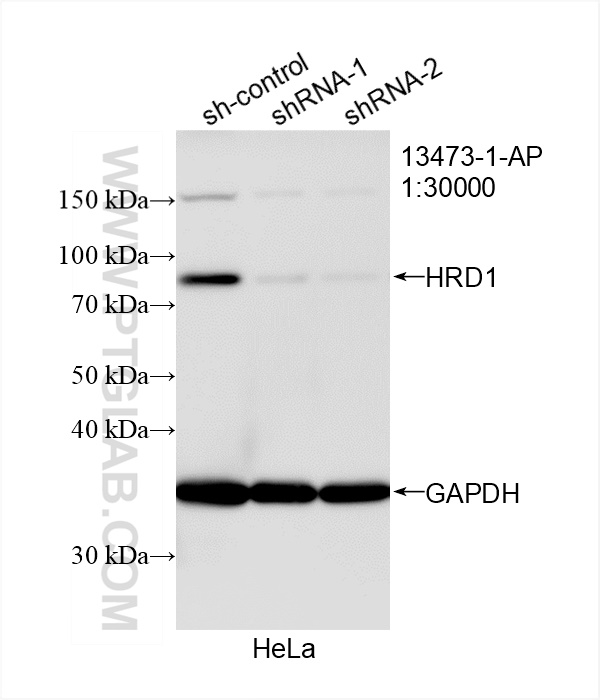 WB analysis of HeLa using 13473-1-AP