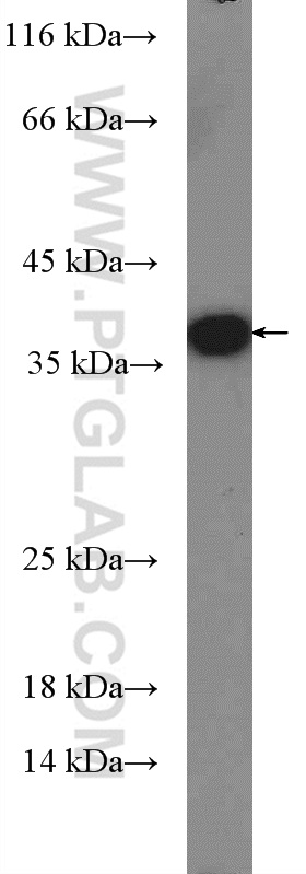 WB analysis of Recombinant protein using 26927-1-AP