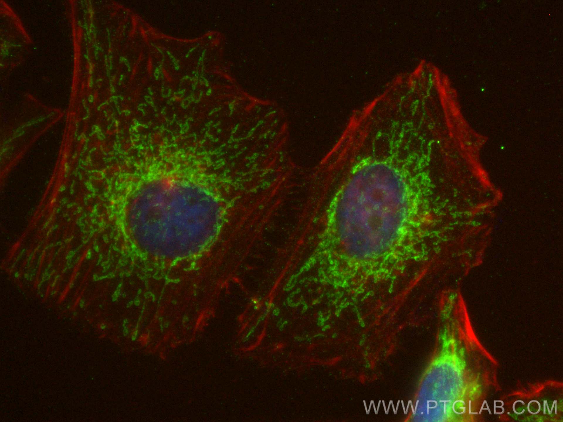 IF Staining of HeLa using 28679-1-AP