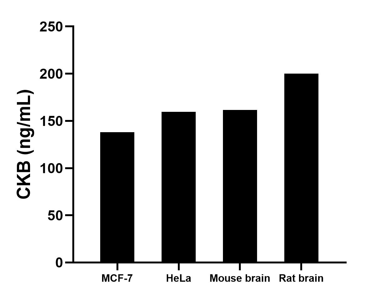 The mean CKB concentration was determined to be 138.08 ng/mL in MCF-7 cell extract based on a 1.20 mg/mL extract load, 159.52 ng/mL in HeLa cell extract based on a 1.30 mg/mL extract load, 161.58 ng/mL in mouse brain tissue extract based on a 6.60 mg/mL extract load and 200.17 ng/mL in rat brain tissue extract based on a 8.20 mg/mL extract load. The mean CKB concentration was determined to be 138.08 ng/mL in MCF-7 cell extract based on a 1.20 mg/mL extract load, 159.52 ng/mL in HeLa cell extract based on a 1.30 mg/mL extract load, 161.58 ng/mL in mouse brain tissue extract based on a 6.60 mg/mL extract load and 200.17 ng/mL in rat brain tissue extract based on a 8.20 mg/mL extract load.