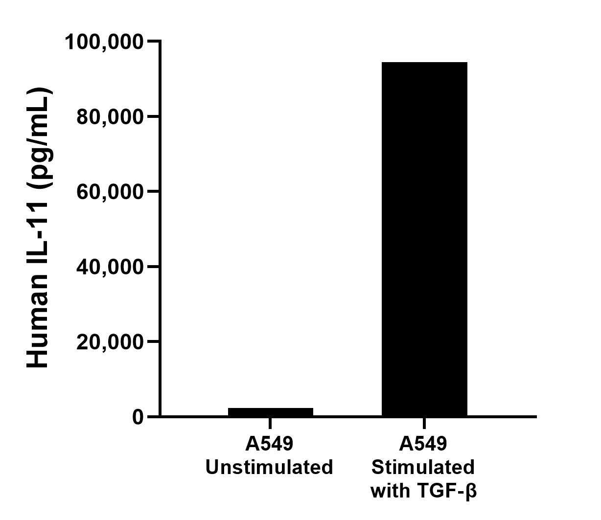 A549 cells were cultured unstimulated or stimulated with 2 ng/mL human TGF-β for 2 days. The mean IL-11 concentration was determined to be 2,309.9
pg/mL in unstimulated A549 supernatant, 94,433.7 pg/mL in stimulated A549 supernatant. A549 cells were cultured unstimulated or stimulated with 2 ng/mL human TGF-β for 2 days. The mean IL-11 concentration was determined to be 2,309.9
pg/mL in unstimulated A549 supernatant, 94,433.7 pg/mL in stimulated A549 supernatant.