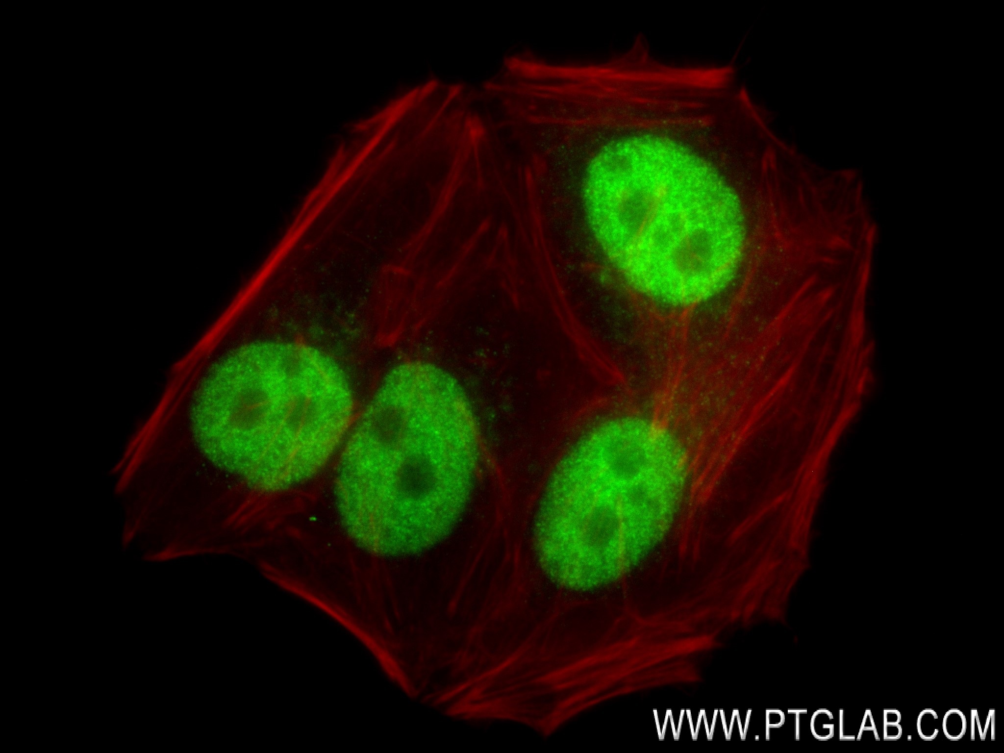 IF Staining of HepG2 using 83981-4-RR