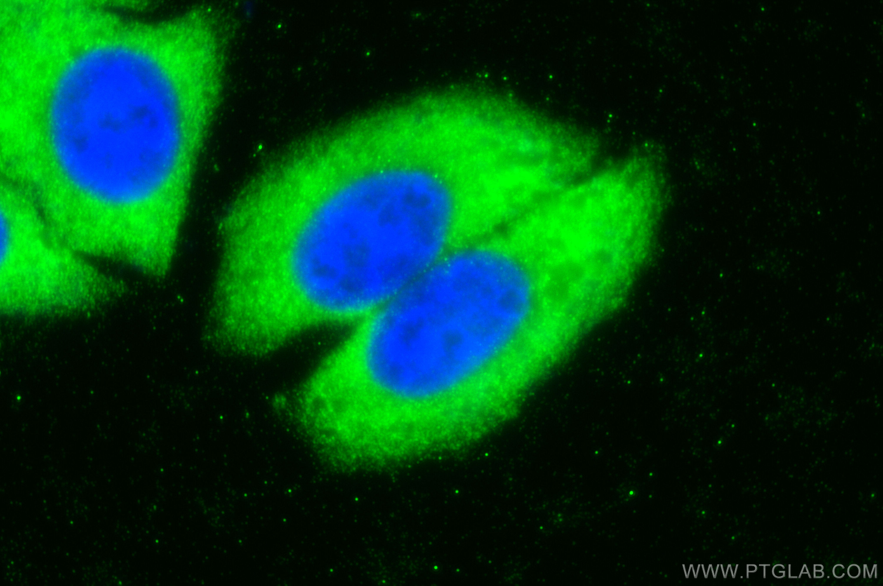 IF Staining of HepG2 using 30249-1-AP