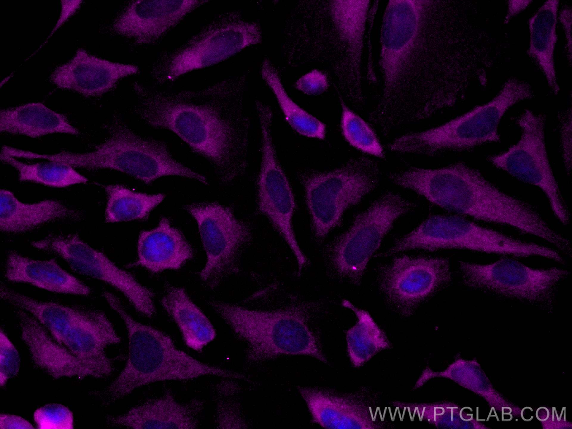 IF Staining of HeLa using CL647-14672