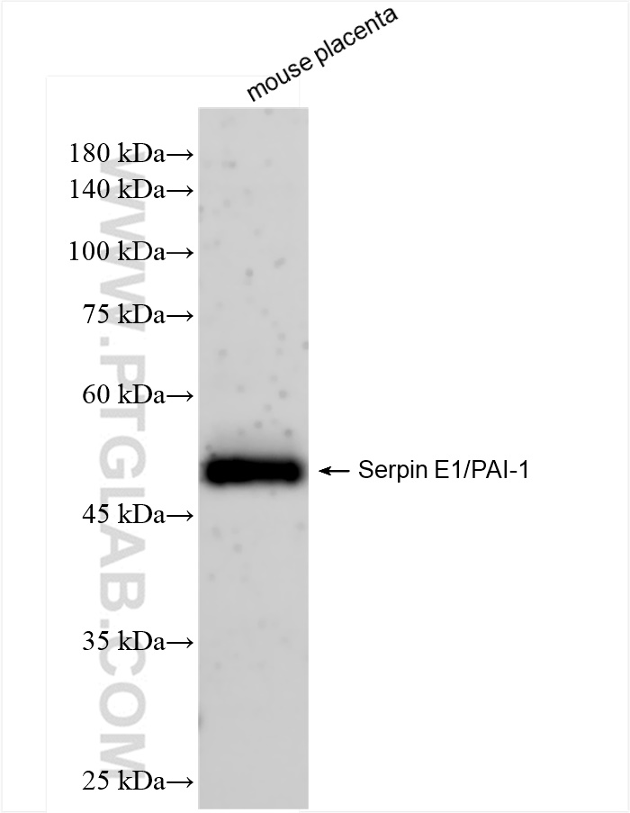 WB analysis of mouse placenta using 83980-3-RR (same clone as 83980-3-PBS)