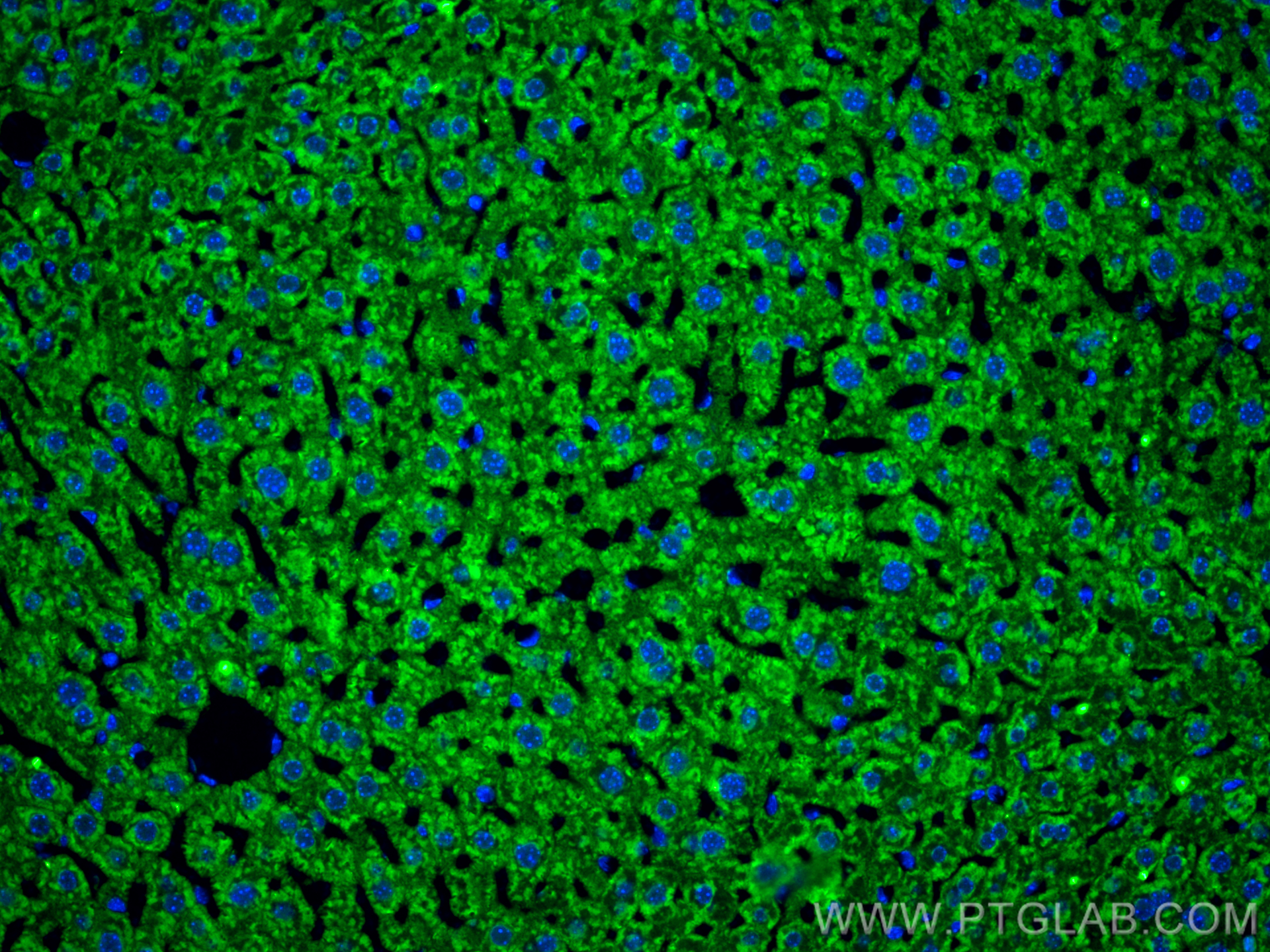 IF Staining of mouse liver using 31813-1-AP