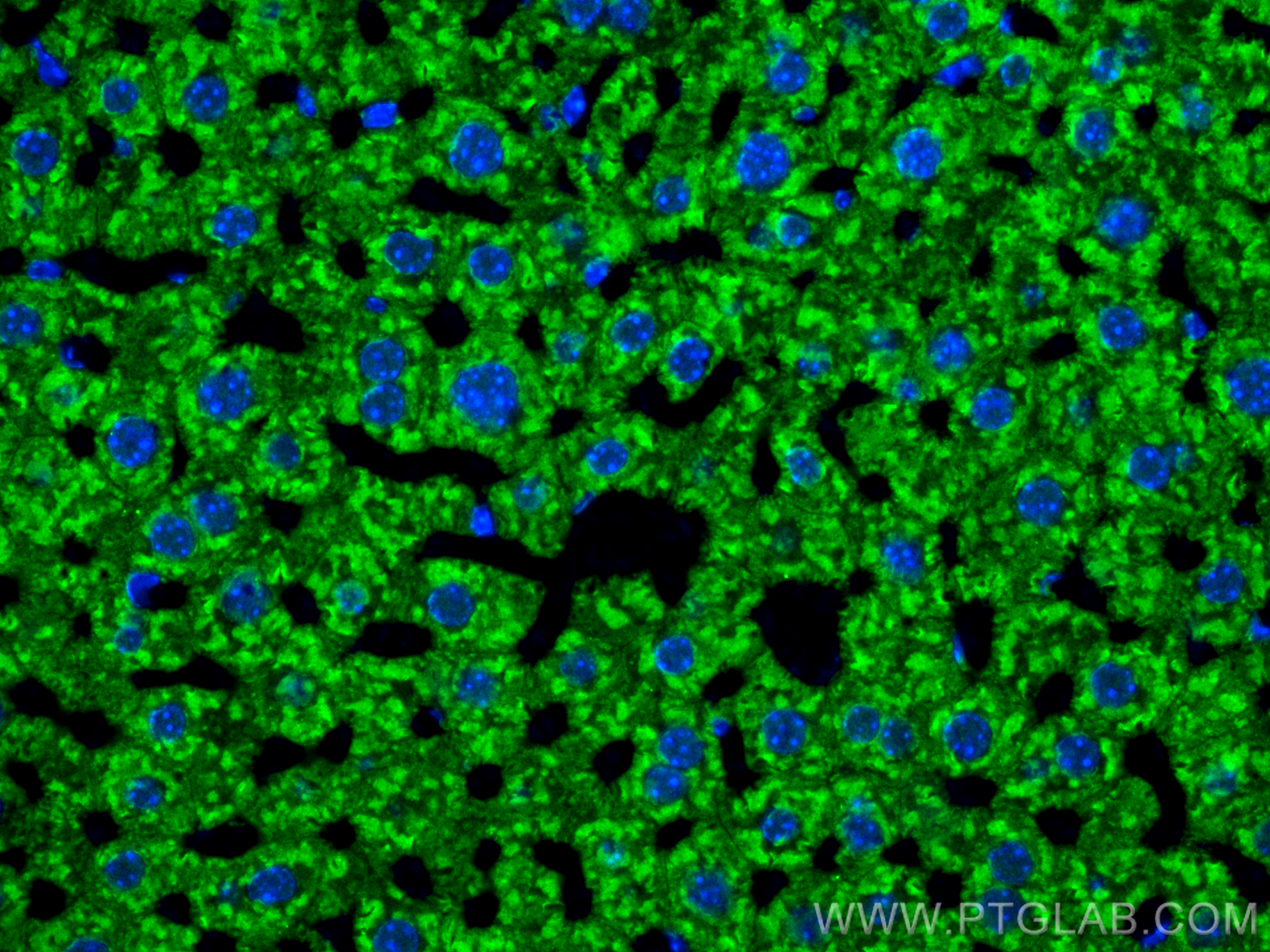 IF Staining of mouse liver using 31813-1-AP