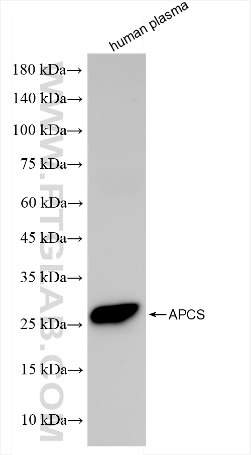 WB analysis of human plasma using 84402-1-RR