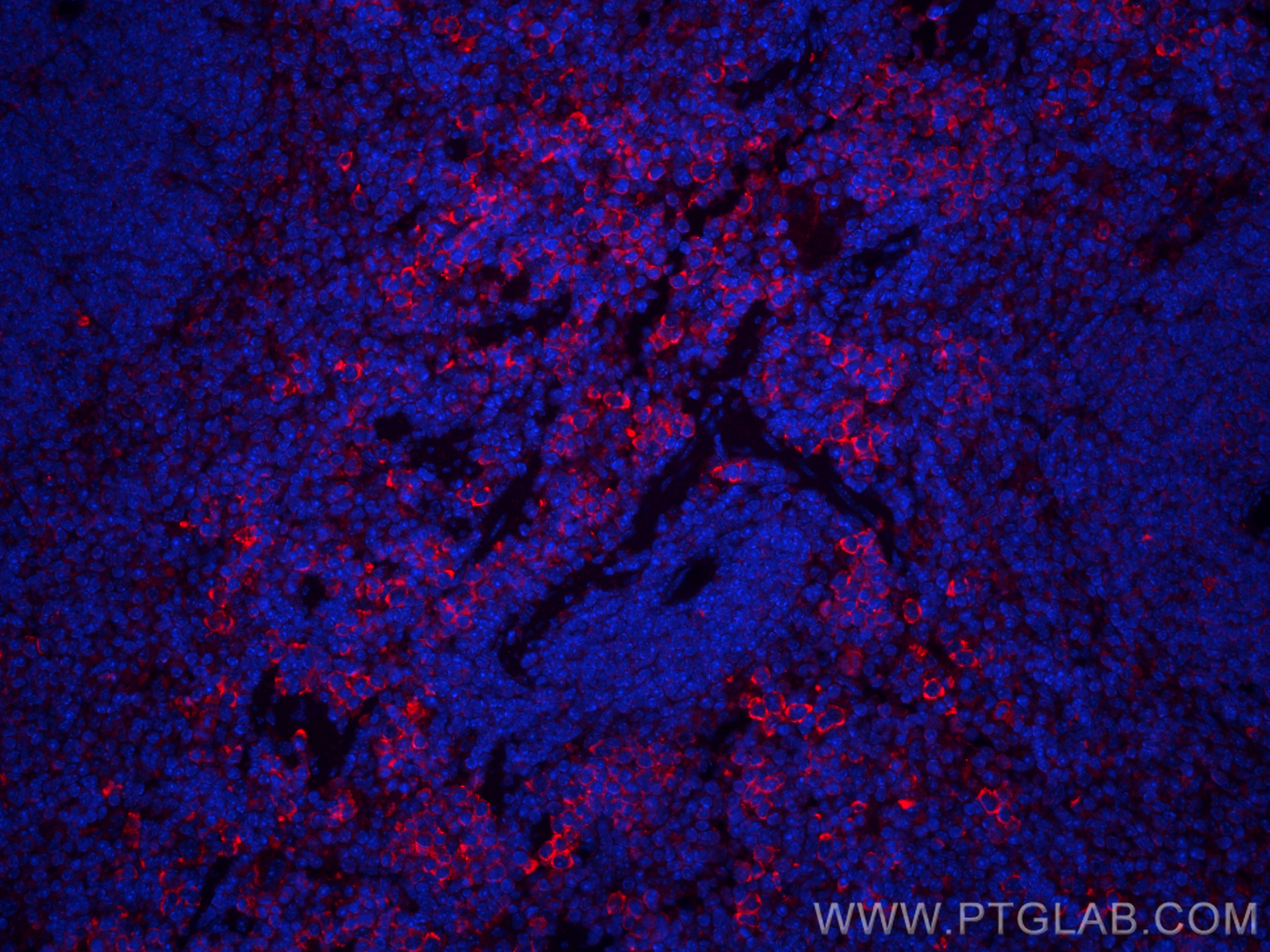 IF Staining of mouse spleen using CL594-66084