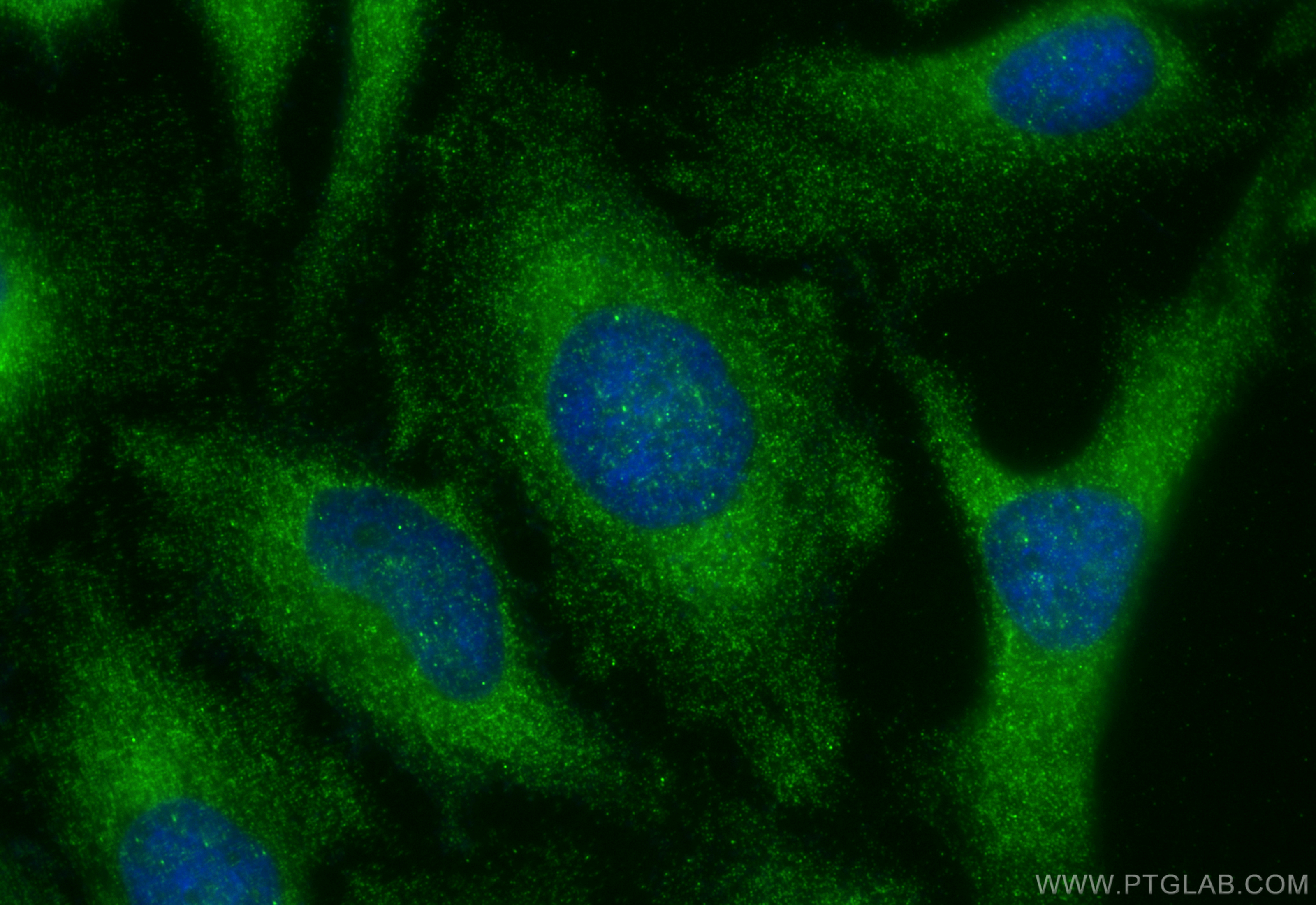 IF Staining of HeLa using 10795-1-AP