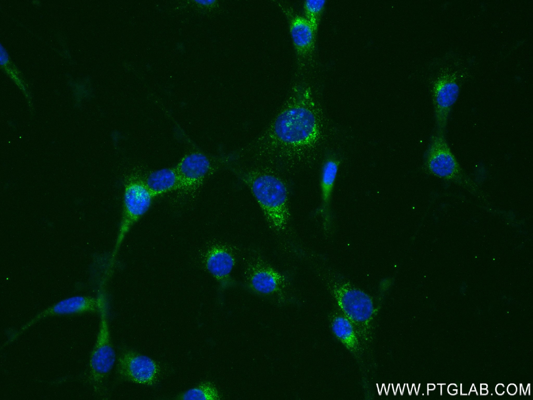 IF Staining of NIH/3T3 using 83280-1-RR (same clone as 83280-1-PBS)