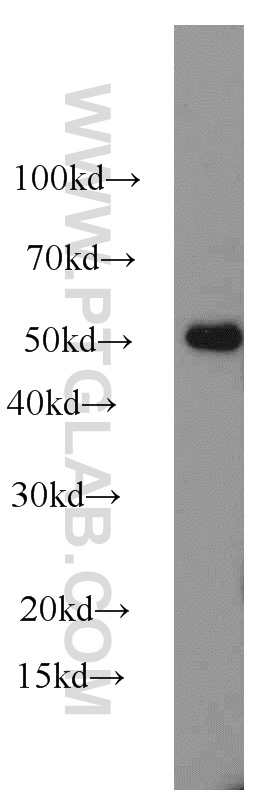 WB analysis of mouse bladder using 19560-1-AP