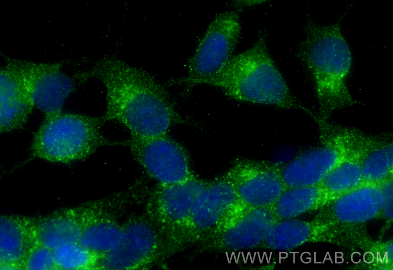 IF Staining of SH-SY5Y using 68007-1-Ig