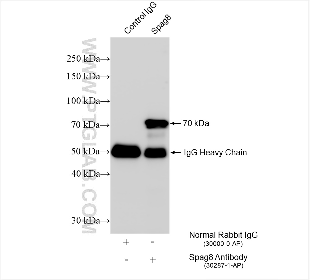 IP experiment of mouse testis using 30287-1-AP