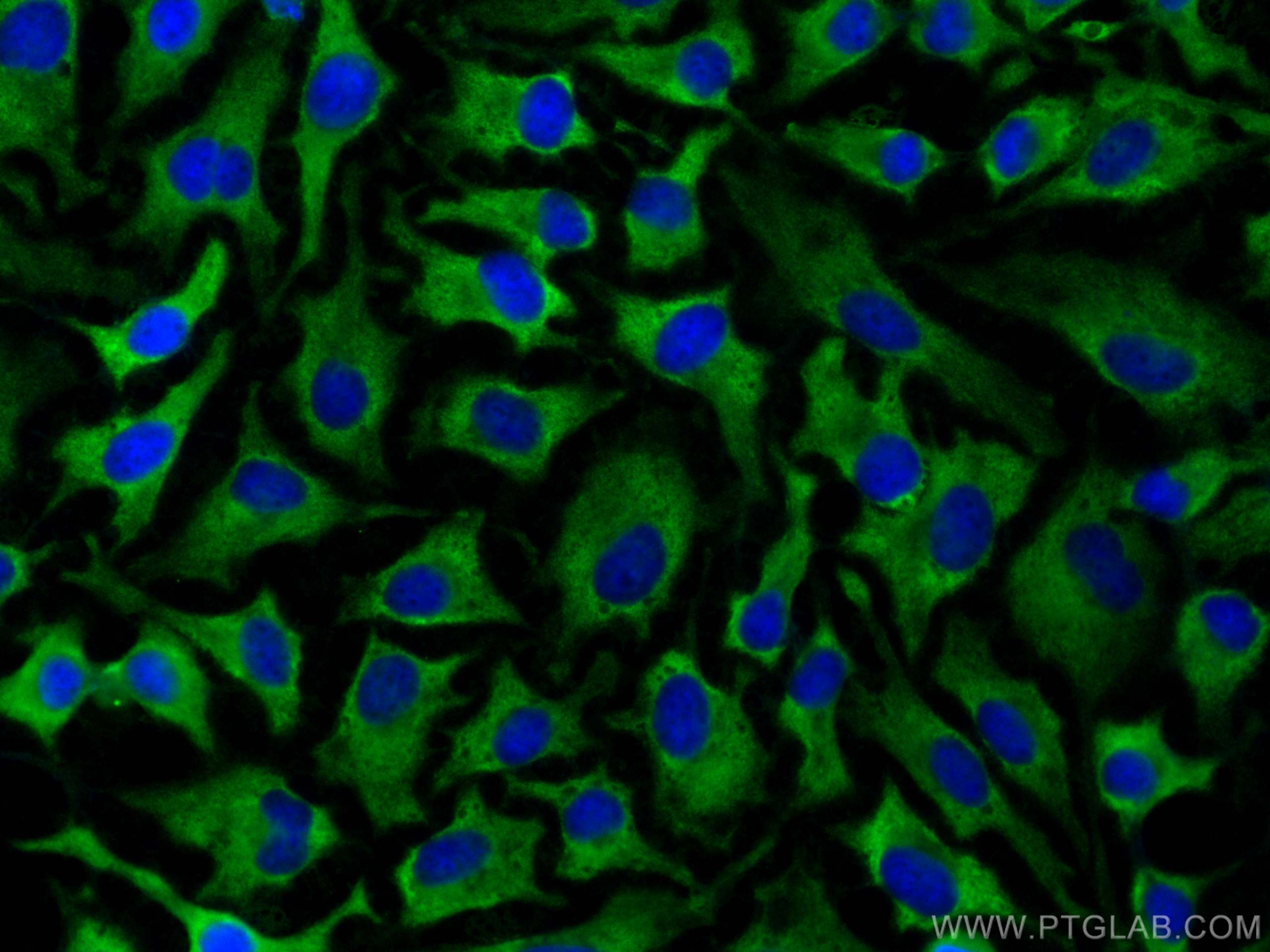 IF Staining of HeLa using CL488-82559