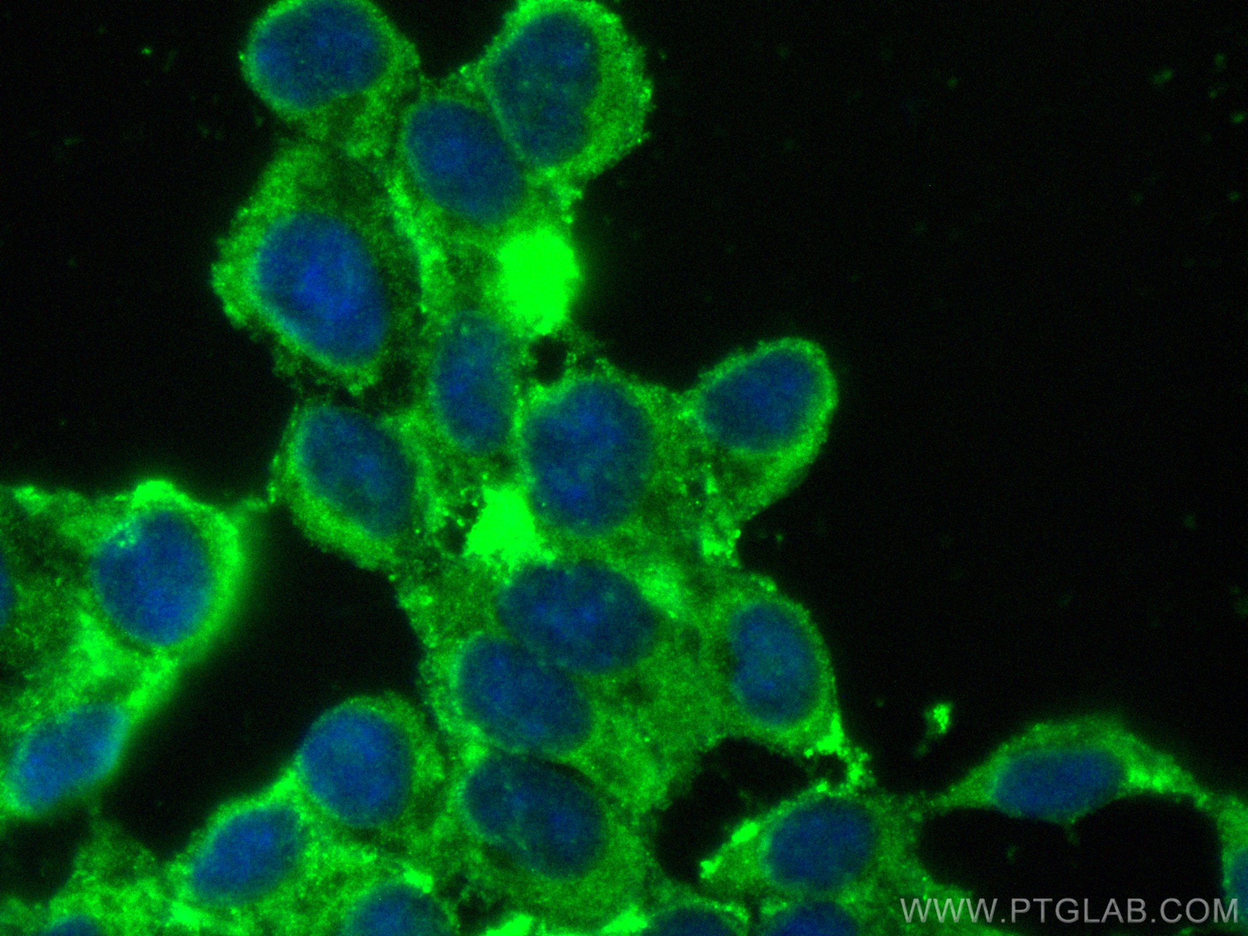 IF Staining of SH-SY5Y using CL488-13893