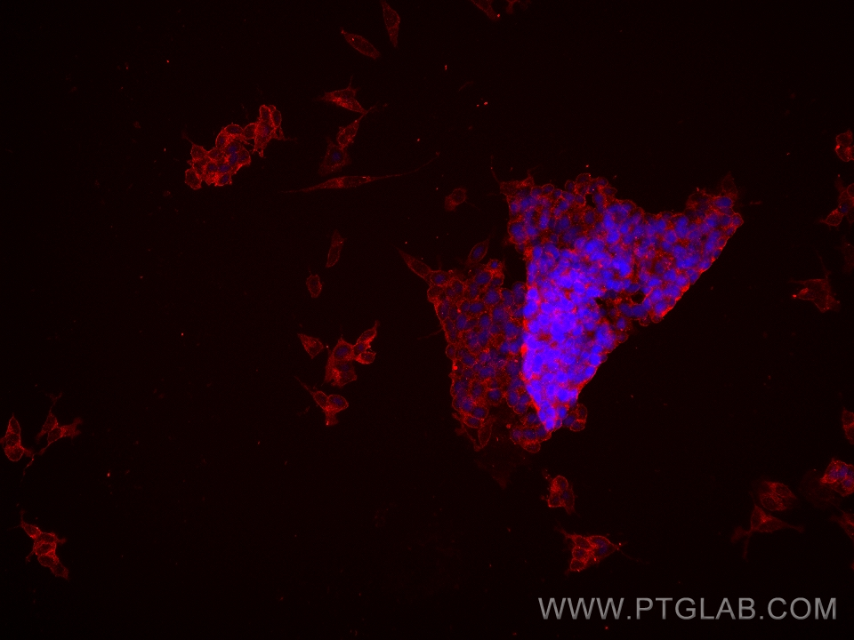 IF Staining of SH-SY5Y using 67864-1-Ig