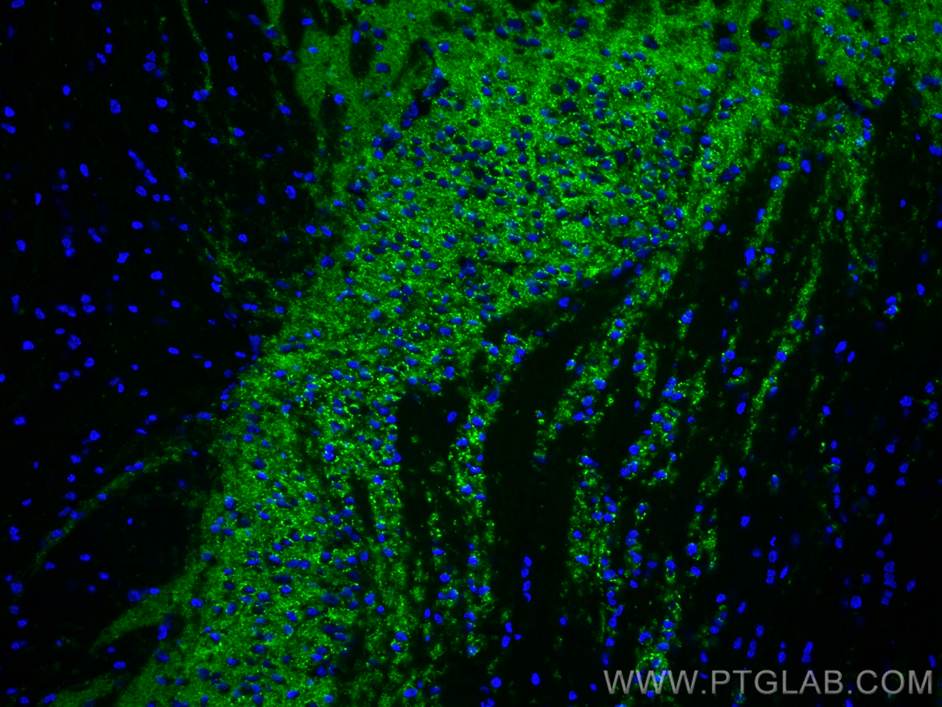 Synaptophysin