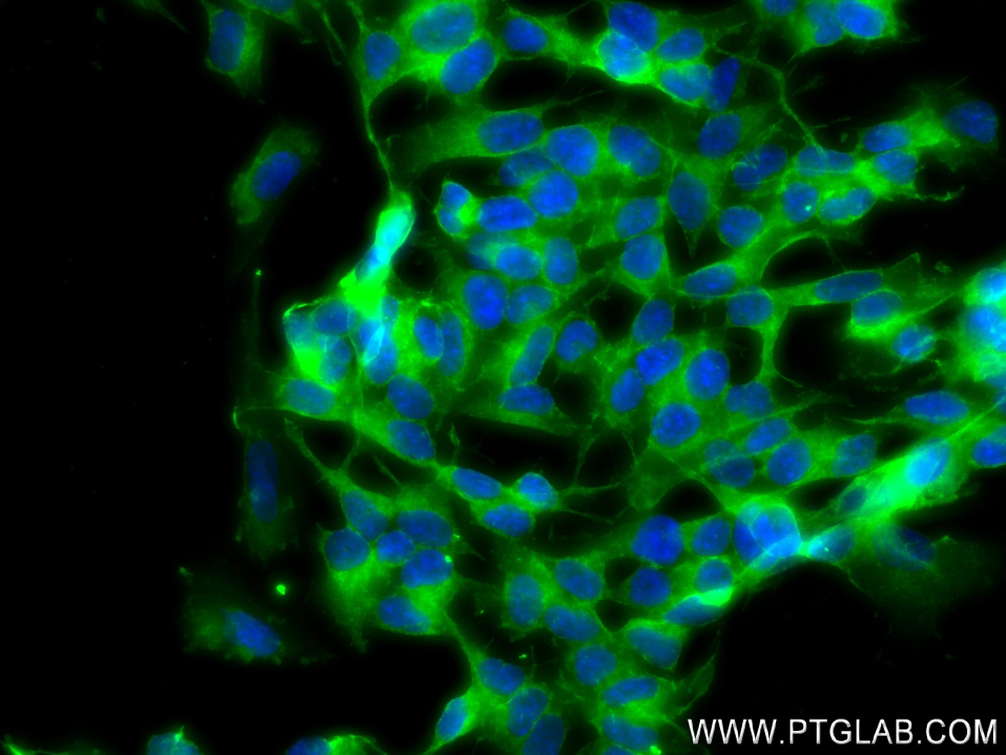 IF Staining of SH-SY5Y using 83637-4-RR (same clone as 83637-4-PBS)