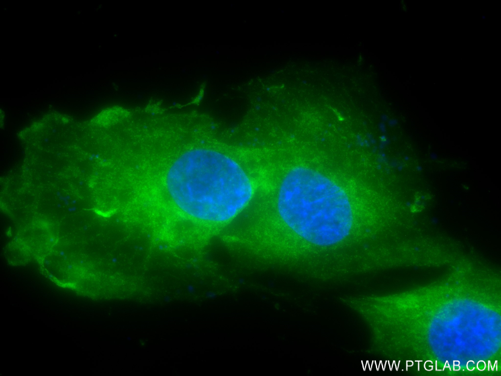 IF Staining of SH-SY5Y using 83637-4-RR