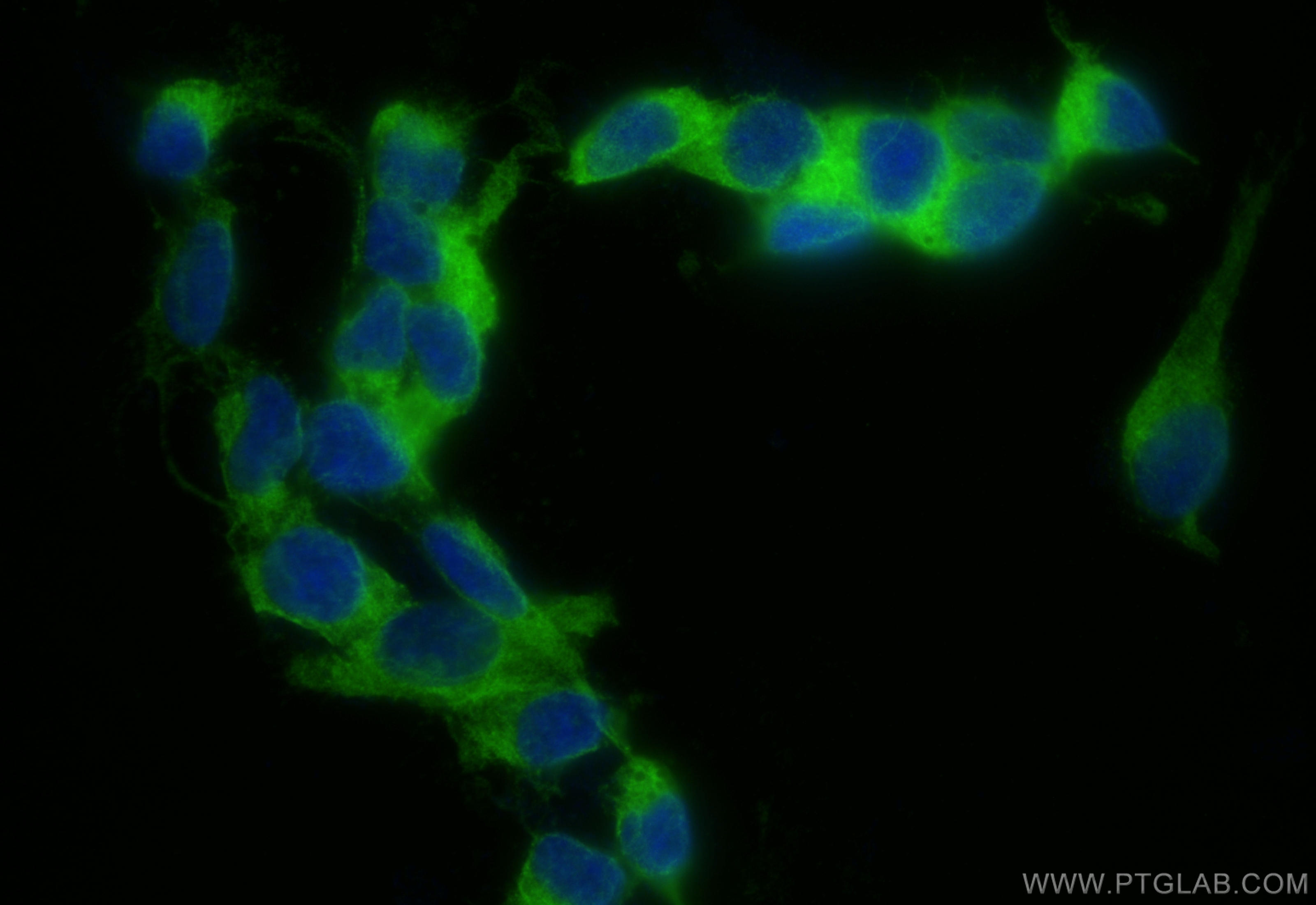 IF Staining of SH-SY5Y using CL488-83637-4