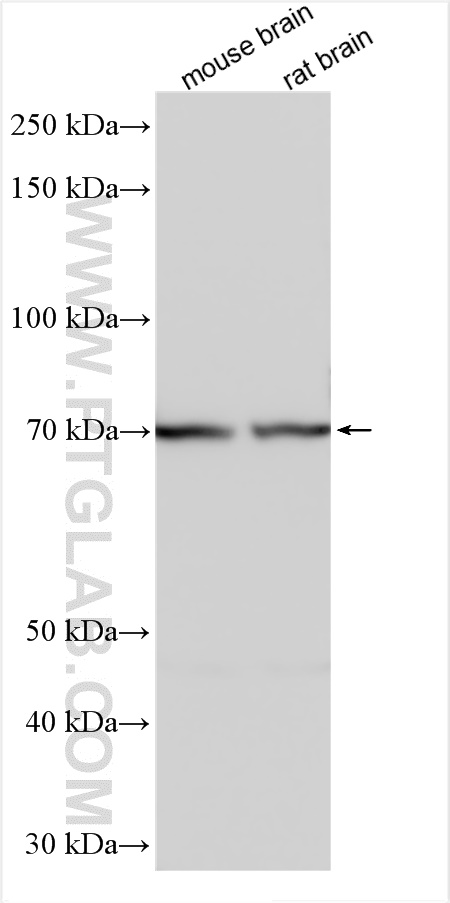 WB analysis using 20881-1-AP