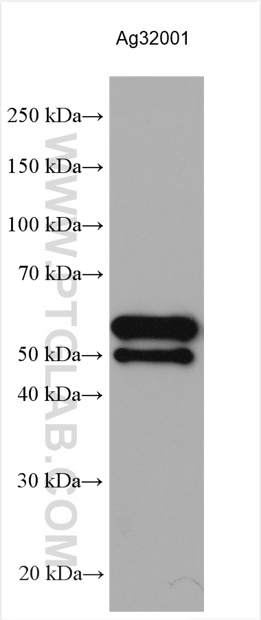 WB analysis of Recombinant protein using 29943-1-AP
