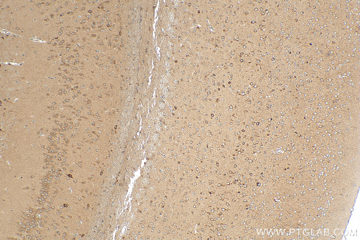 IHC staining of mouse brain using 28599-1-AP