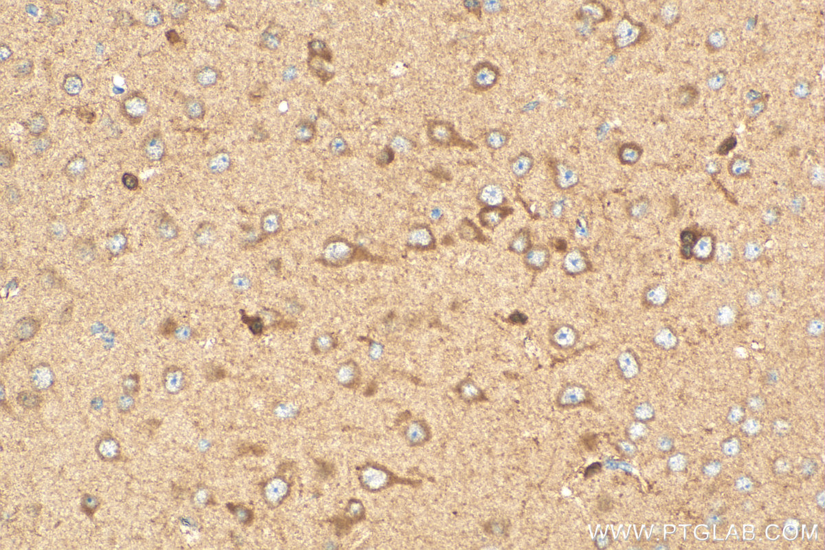 IHC staining of mouse brain using 28599-1-AP