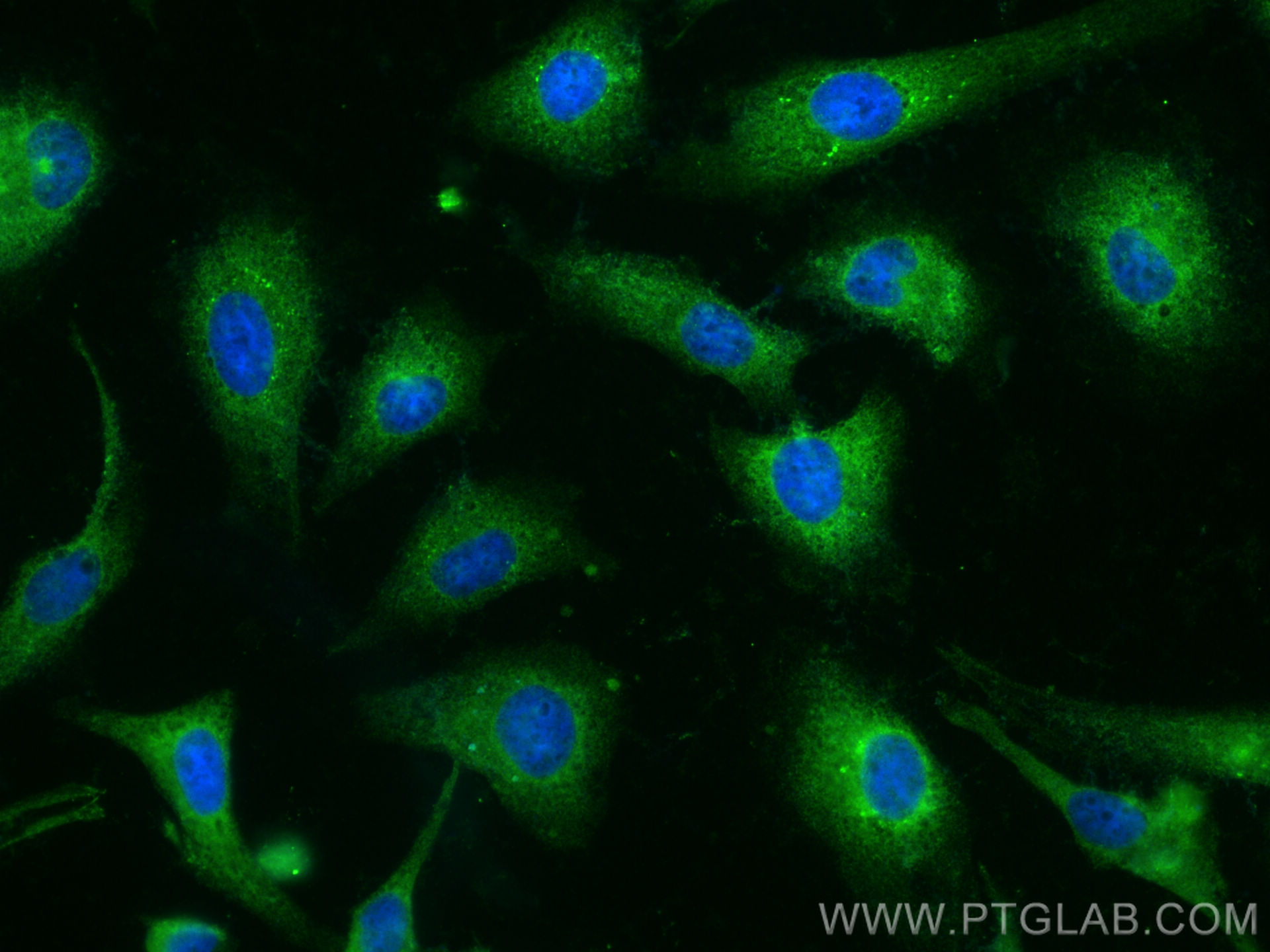 IF Staining of HeLa using 13862-1-AP