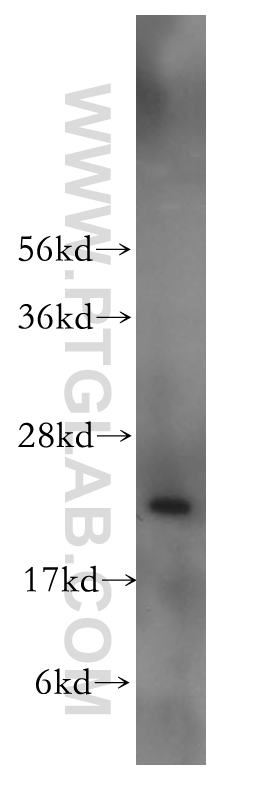 WB analysis of Y79 using 12353-1-AP