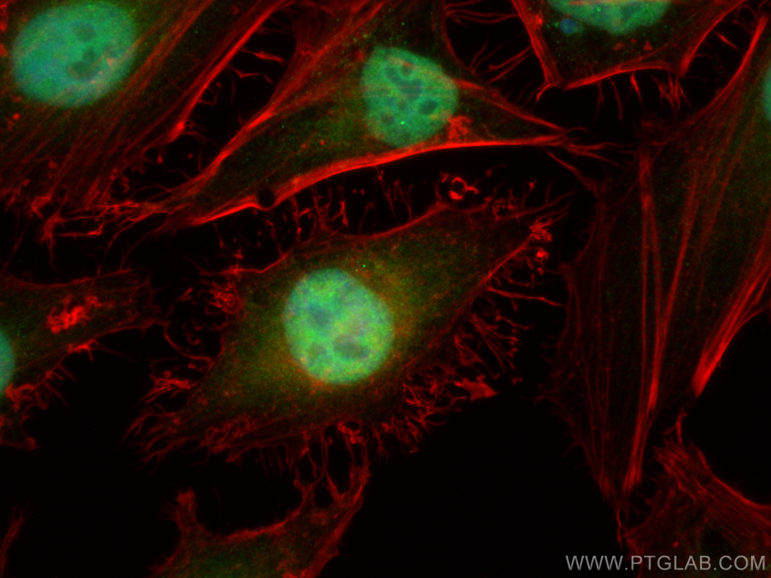 IF Staining of HeLa using 24235-1-AP