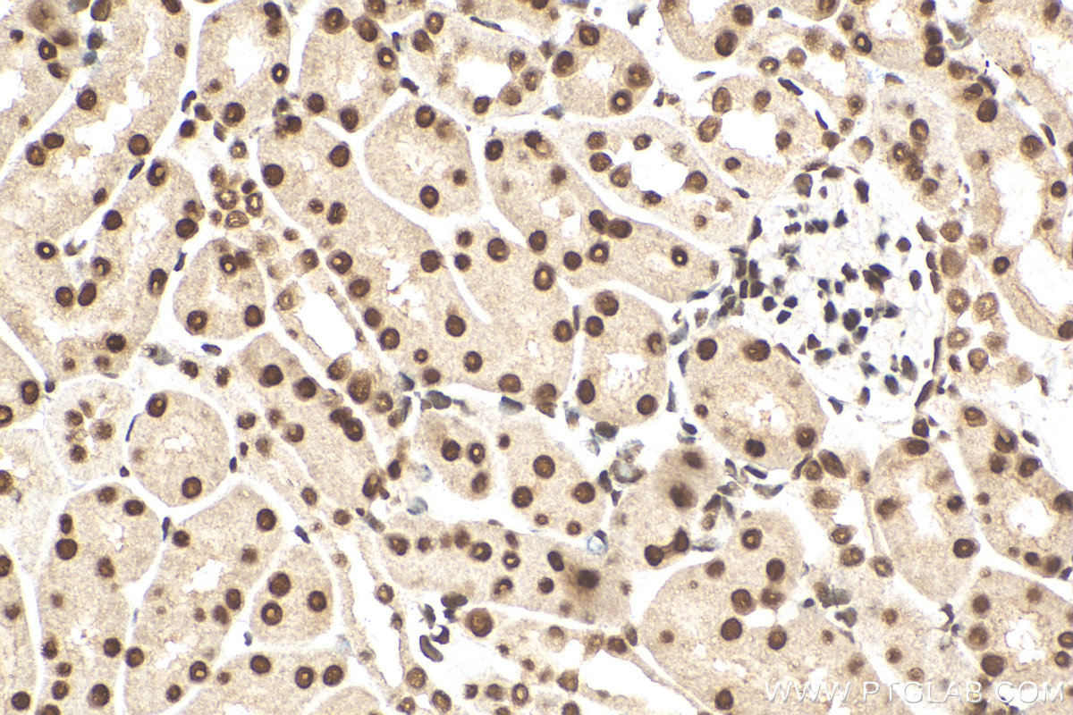 IHC staining of mouse kidney using 82860-1-RR