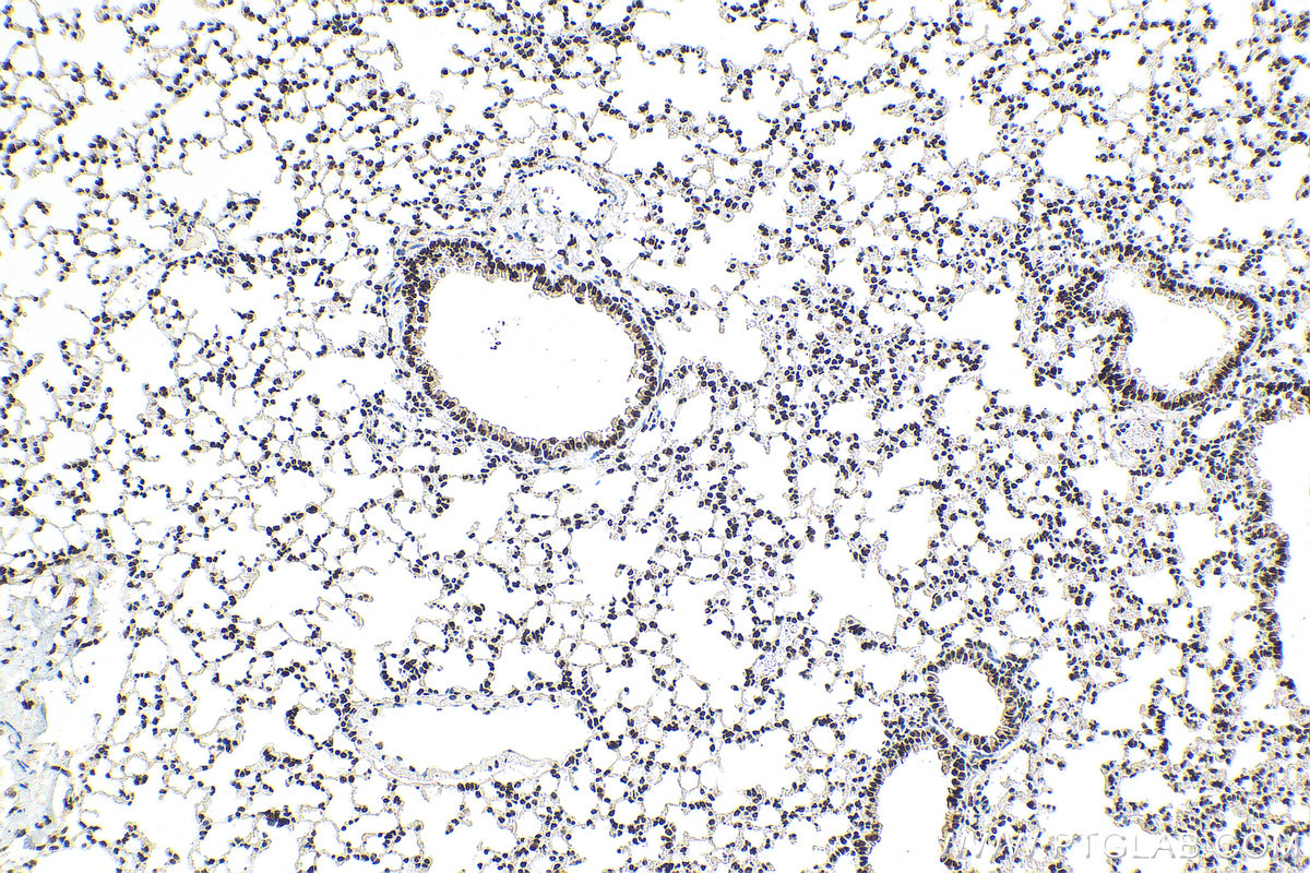 IHC staining of mouse lung using 82860-1-RR