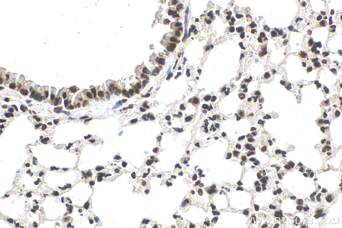 IHC staining of mouse lung using 82860-1-RR