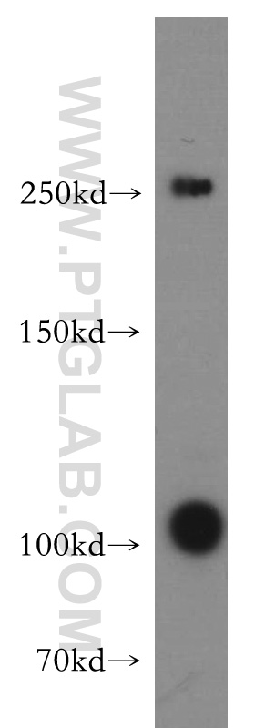 WB analysis of human testis using 55170-1-AP