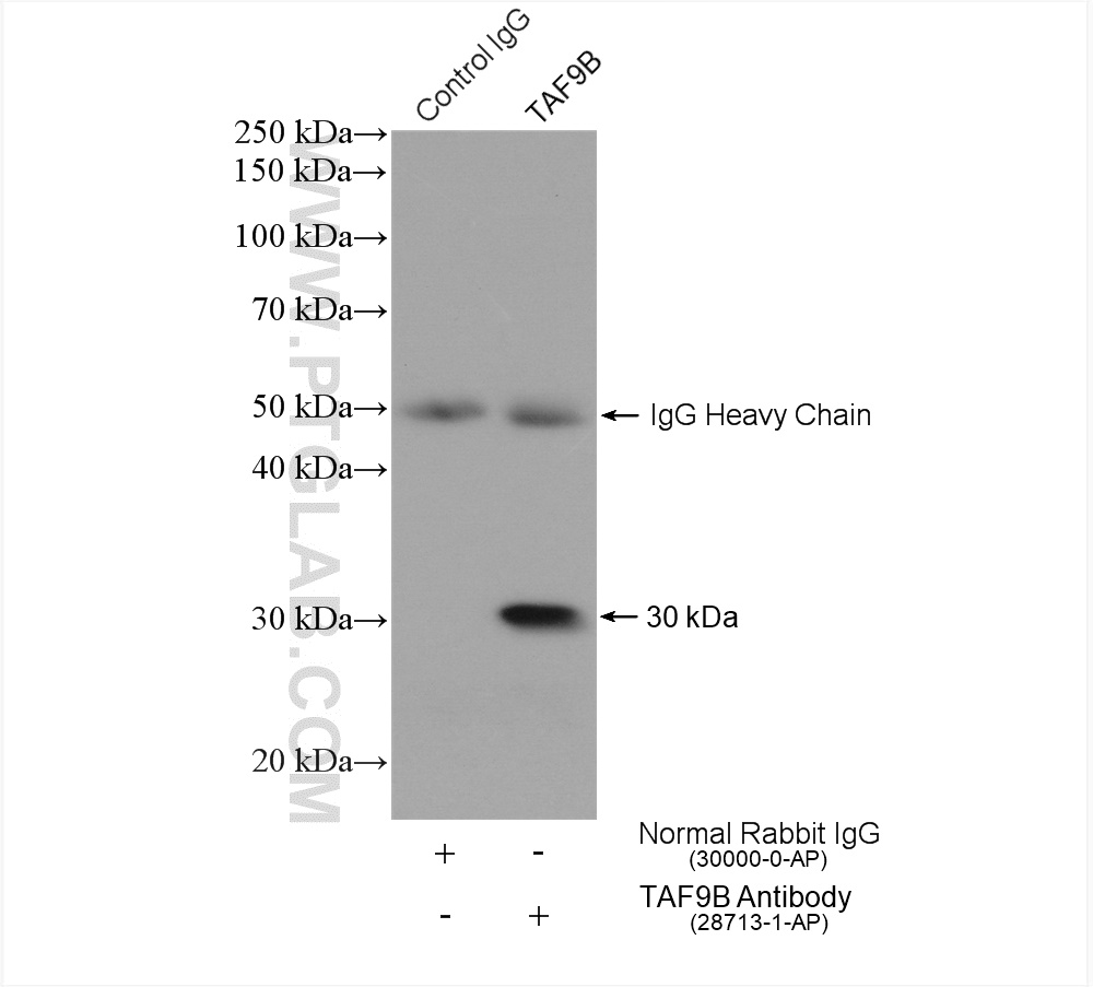 IP experiment of HeLa using 28713-1-AP (same clone as 28713-1-PBS)