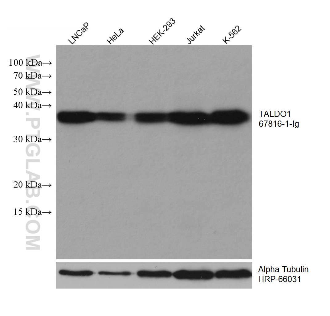 WB analysis using 67816-1-Ig