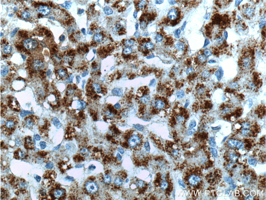 IHC staining of human liver using 26250-1-AP