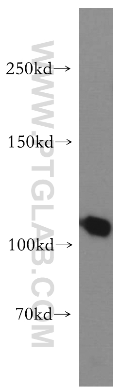 WB analysis of human liver using 10158-2-AP