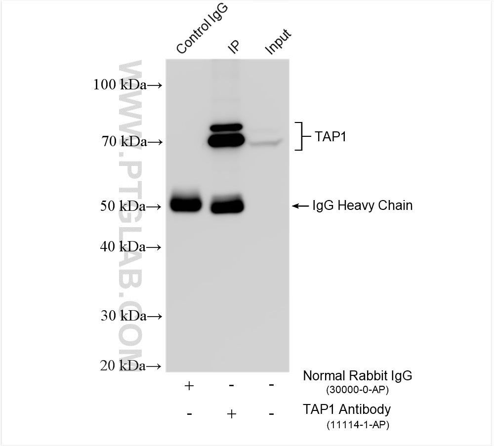 IP experiment of HepG2 using 11114-1-AP