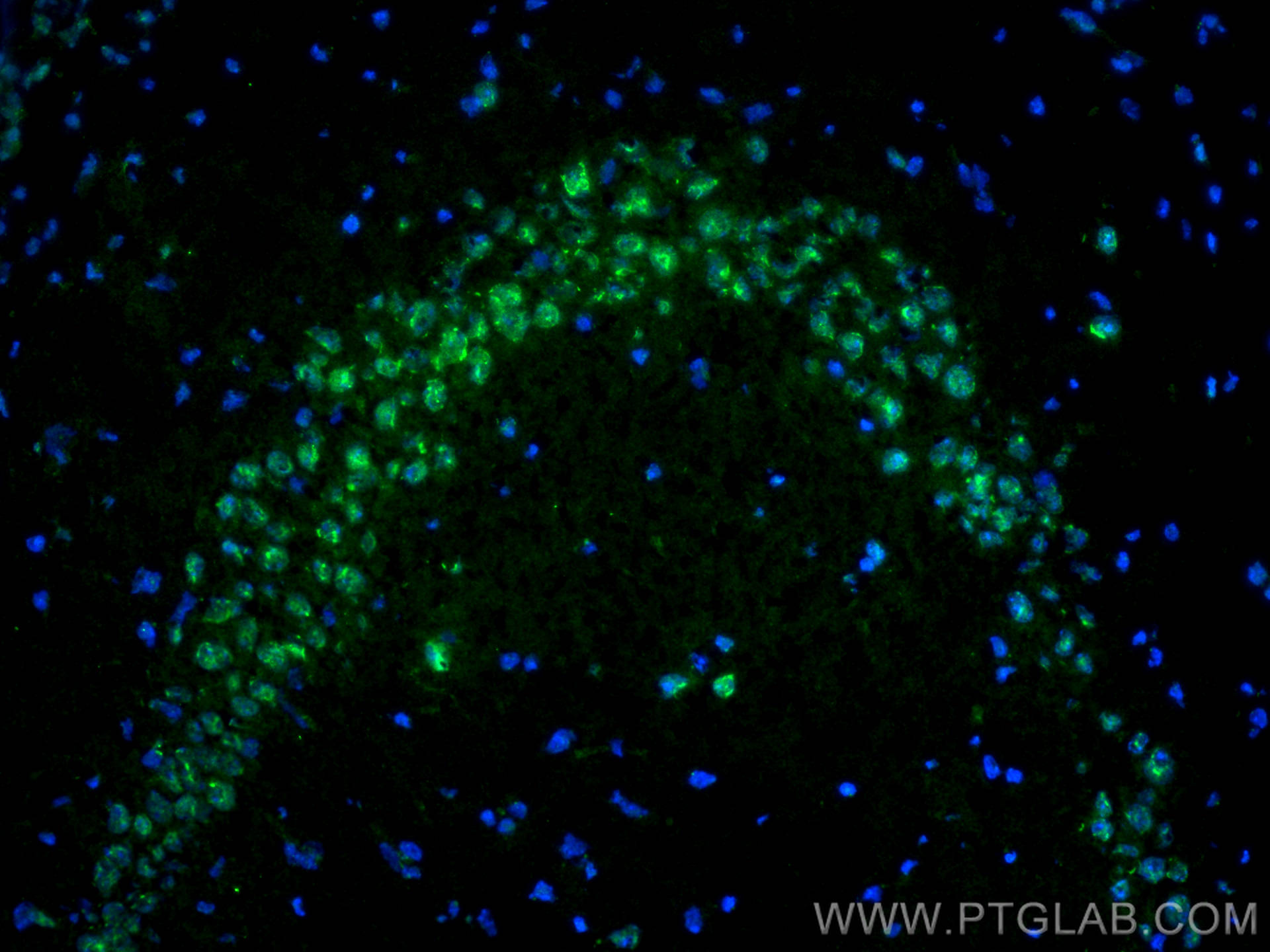 IF Staining of mouse brain using 12892-1-AP