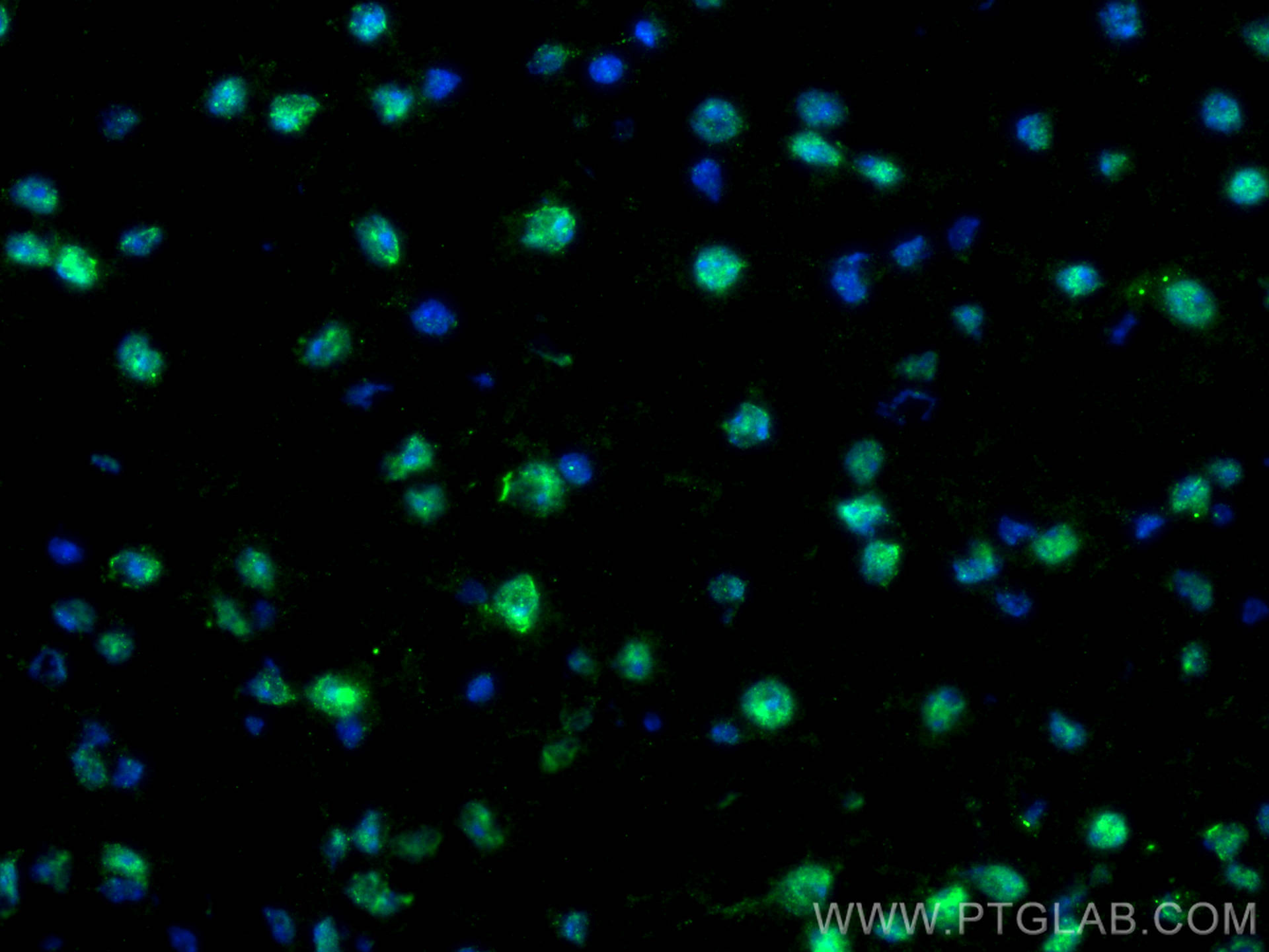 IF Staining of mouse brain using 12892-1-AP