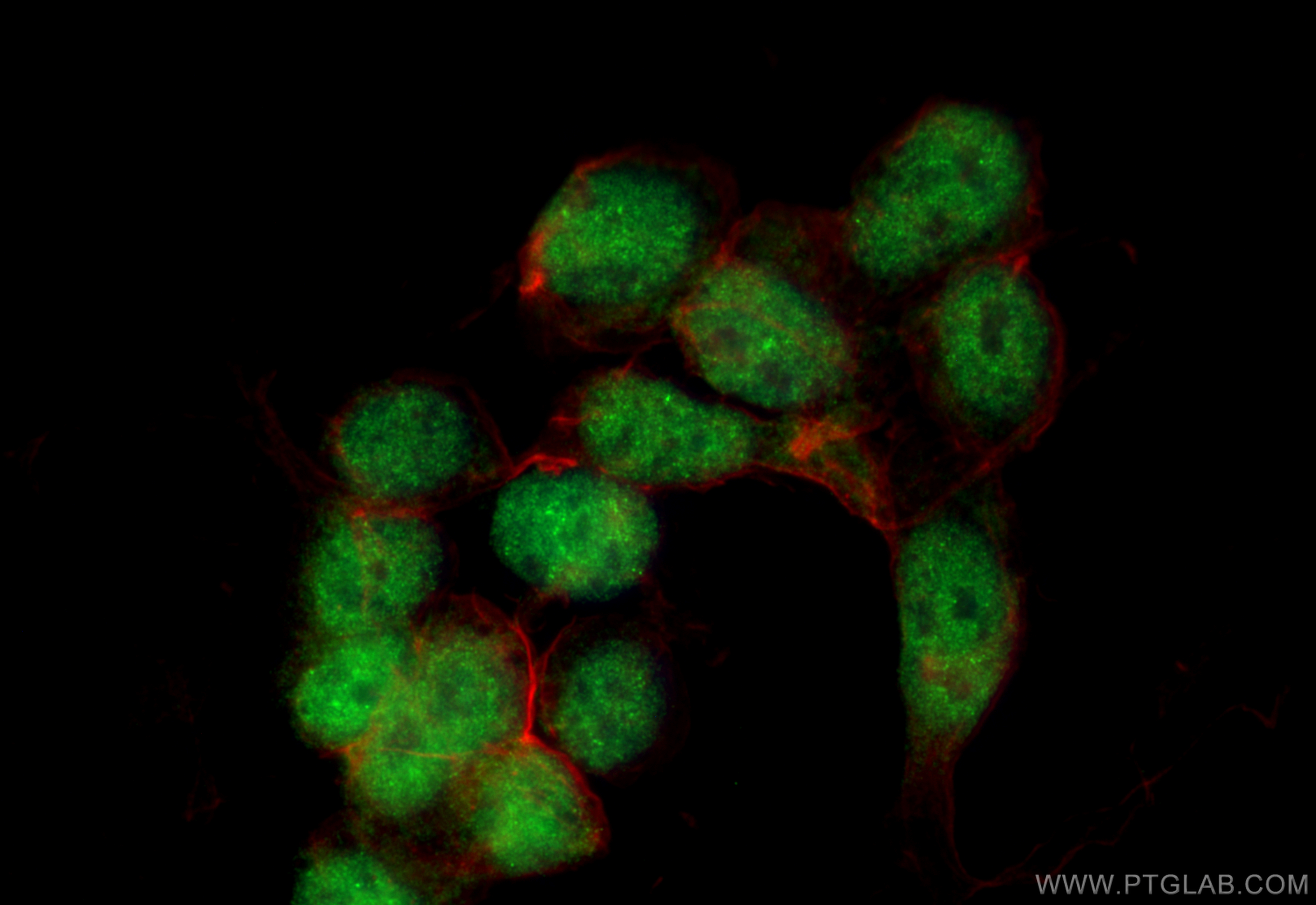 IF Staining of SH-SY5Y using 18280-1-AP