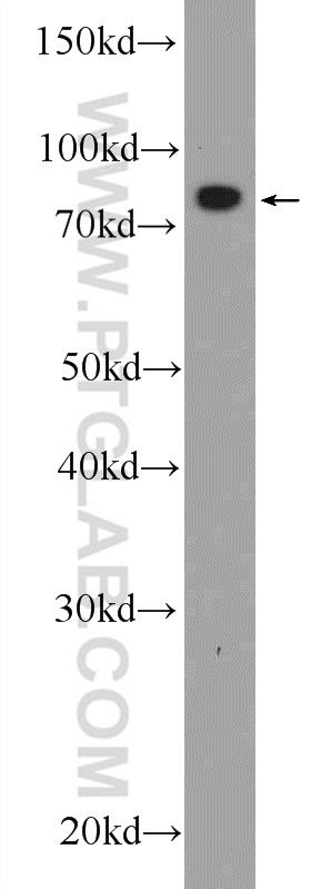 WB analysis of HepG2 using 15067-1-AP