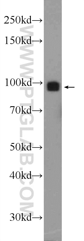 WB analysis of L02 using 24635-1-AP